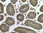 p19 INK4d Antibody in Immunohistochemistry (Paraffin) (IHC (P))