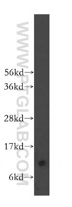 FKBP1A Antibody in Western Blot (WB)