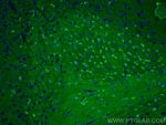 TAU Antibody in Immunohistochemistry (PFA fixed) (IHC (PFA))