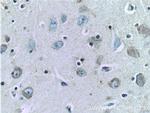 TAU Antibody in Immunohistochemistry (Paraffin) (IHC (P))
