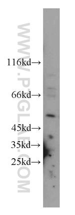 SNX17 Antibody in Western Blot (WB)