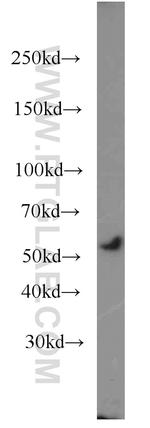 SNX17 Antibody in Western Blot (WB)