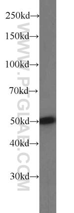 SNX17 Antibody in Western Blot (WB)