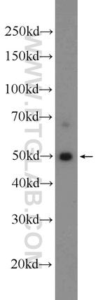 SNX17 Antibody in Western Blot (WB)