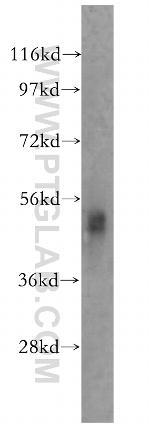 SNX17 Antibody in Western Blot (WB)