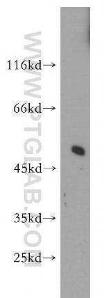 SNX17 Antibody in Western Blot (WB)