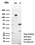 p57Kip2 (Mitotic Inhibitor/Suppressor Protein) Antibody in SDS-PAGE (SDS-PAGE)