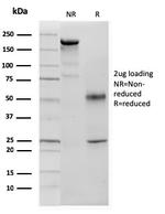 p57Kip2 (Mitotic Inhibitor/Suppressor Protein) Antibody in SDS-PAGE (SDS-PAGE)