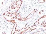 p57Kip2 (Mitotic Inhibitor/Suppressor Protein) Antibody in Immunohistochemistry (Paraffin) (IHC (P))