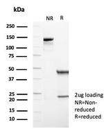 p57Kip2 (Mitotic Inhibitor/Suppressor Protein) Antibody in SDS-PAGE (SDS-PAGE)