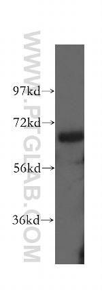 AATF Antibody in Western Blot (WB)