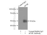 uPAR Antibody in Immunoprecipitation (IP)