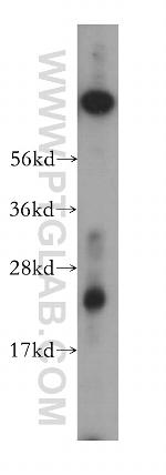 CYPC Antibody in Western Blot (WB)