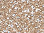 p14ARF Antibody in Immunohistochemistry (Paraffin) (IHC (P))