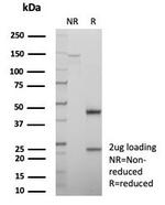 P16INK4a Antibody in SDS-PAGE (SDS-PAGE)