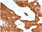 P16INK4a Antibody in Immunohistochemistry (Paraffin) (IHC (P))