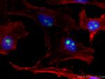 EIF6 Antibody in Immunocytochemistry (ICC/IF)