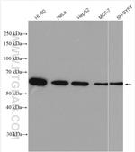 calreticulin Antibody in Western Blot (WB)