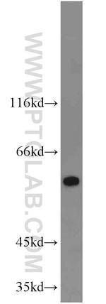 calreticulin Antibody in Western Blot (WB)