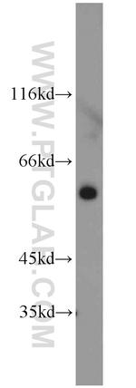 calreticulin Antibody in Western Blot (WB)