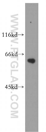 calreticulin Antibody in Western Blot (WB)