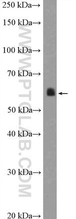 calreticulin Antibody in Western Blot (WB)