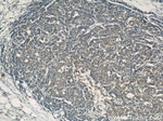 CCM3/PDCD10 Antibody in Immunohistochemistry (Paraffin) (IHC (P))