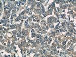 CCM3/PDCD10 Antibody in Immunohistochemistry (Paraffin) (IHC (P))