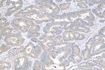 CCM3/PDCD10 Antibody in Immunohistochemistry (Paraffin) (IHC (P))