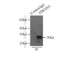 CCM3/PDCD10 Antibody in Immunoprecipitation (IP)