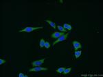 Aurora A Antibody in Immunocytochemistry (ICC/IF)