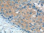 Aurora A Antibody in Immunohistochemistry (Paraffin) (IHC (P))