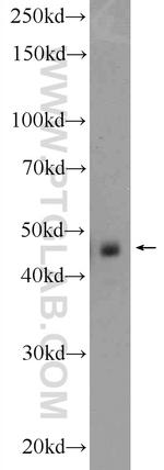 Aurora A Antibody in Western Blot (WB)