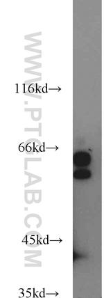 Lamin A/C Antibody in Western Blot (WB)