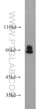 Lamin A/C Antibody in Western Blot (WB)