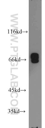 Lamin A/C Antibody in Western Blot (WB)