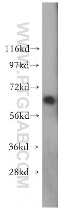 Lamin A/C Antibody in Western Blot (WB)