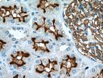 MME/CD10 Antibody in Immunohistochemistry (Paraffin) (IHC (P))