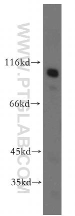 MME/CD10 Antibody in Western Blot (WB)