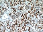 MME/CD10 Antibody in Immunohistochemistry (Paraffin) (IHC (P))