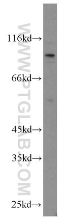 MME/CD10 Antibody in Western Blot (WB)