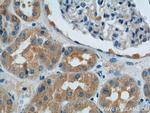 SNX1 Antibody in Immunohistochemistry (Paraffin) (IHC (P))