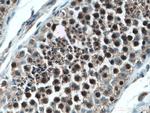 PLK1 Antibody in Immunohistochemistry (Paraffin) (IHC (P))