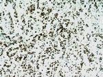 B23/NPM1 Antibody in Immunohistochemistry (Paraffin) (IHC (P))