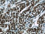 B23/NPM1 Antibody in Immunohistochemistry (Paraffin) (IHC (P))