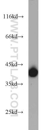 B23/NPM1 Antibody in Western Blot (WB)