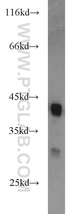 B23/NPM1 Antibody in Western Blot (WB)