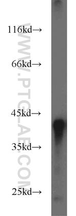 B23/NPM1 Antibody in Western Blot (WB)