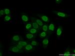 B23/NPM1 Antibody in Immunocytochemistry (ICC/IF)