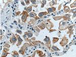 GPRC5A/RAI3 Antibody in Immunohistochemistry (Paraffin) (IHC (P))